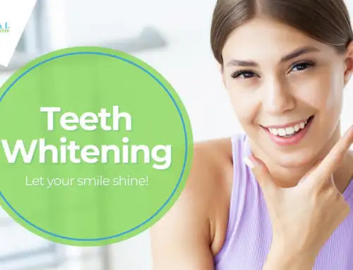 Comprehensive Guide to Teeth Whitening in Pompano Beach, FL