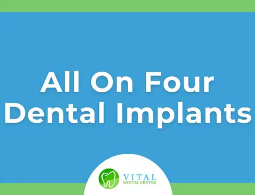 Discover the Life-Changing Benefits of All-on-4 Dental Implants in Pompano Beach, FL