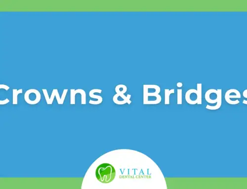 Crowns and Bridges: What You Need to Know About Materials, Maintenance, and Benefits