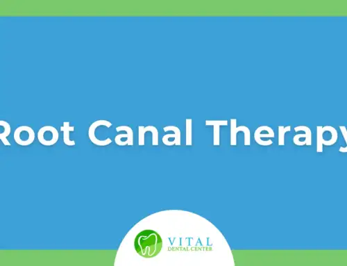 Root Canal Therapy: A Complete Guide to Care and Relief in Margate, FL