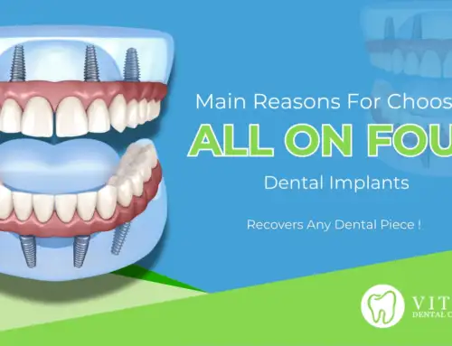 All-on-4 Dental Implants | Vital Dental Center