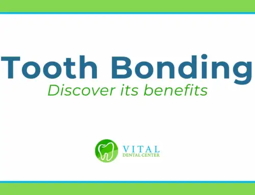 Why Tooth Bonding Is Becoming Everyone’s Favorite Cosmetic Fix