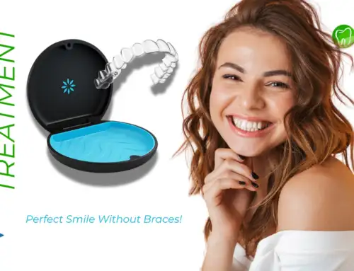 Top Features of Invisalign and the Best Age to Start Treatment