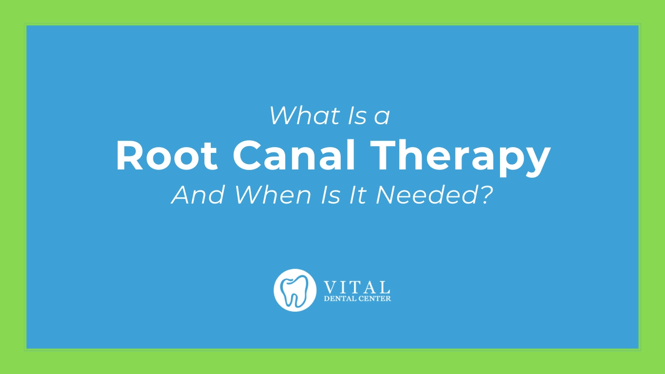 Root Canal Therapy: What It Is and When You Need It