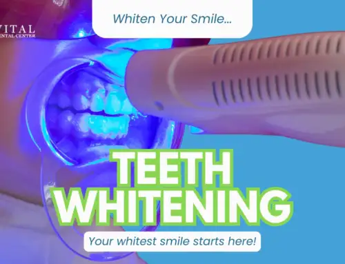 Discover the Benefits of Professional Teeth Whitening at Vital Dental Center